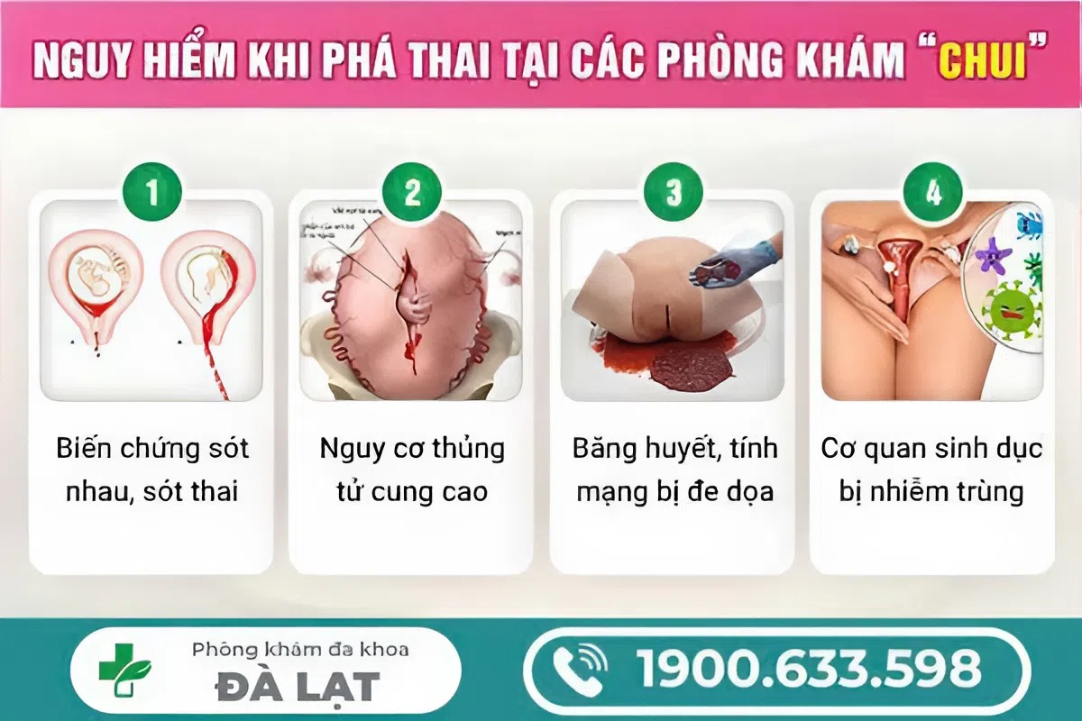 Hình ảnh minh họa